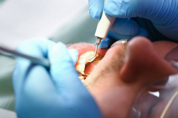 Best Weekend Emergency Dentist in Merryville, LA