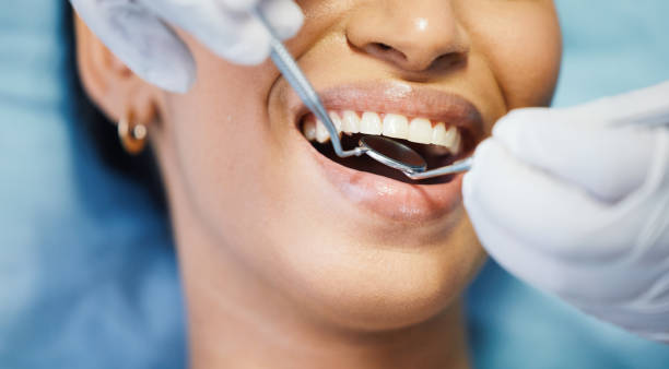 Best Walk-In Emergency Dentist in Merryville, LA