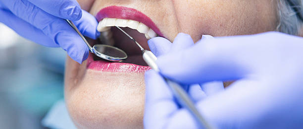 Best Emergency Root Canal Treatment in Merryville, LA